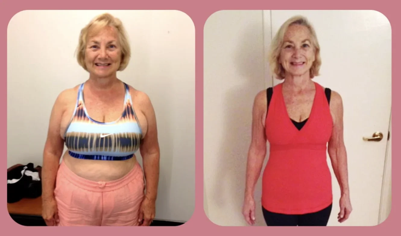 Melinda — before and after